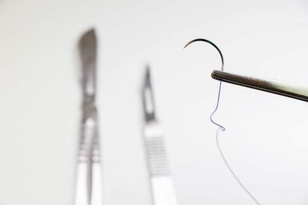stitches sutures or clips